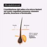 L'Oreal Professionnel Paris Scalp Advanced Anti-Discomfort Shampoo 500ml - beruhigendes Shampoo