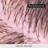 L'Oreal Professionnel Paris Scalp Advanced Anti-Oiliness 2in1 Deep Purifier Clay 250ml - Reinigendes Shampoo & Maske