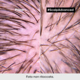 L'Oreal Professionel Scalp Advanced Anti-Discomfort Intense Soother 200ml - beruhigende Behandlung